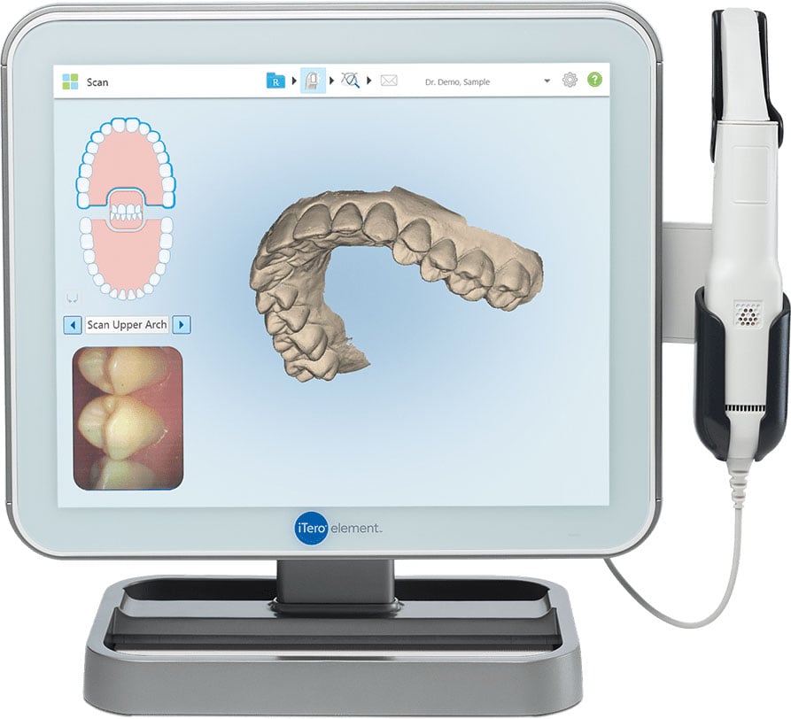 iTero Element Intraoral Scanner in Milwaukee, WI, Beloit, WI and Roscoe, IL